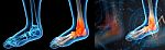 3d Render Illustration Of The Ankle Pain Stock Photo