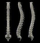 3d Rendered Of Illustration - Human Spine Stock Photo