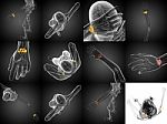 3d Rendering Illustration Of The Human Carpal Bones Stock Photo