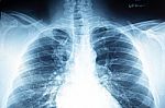 Close Up X-ray Film Stock Photo
