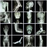 Collection Human Joint ( Skull Head Neck Shoulder Chest Thorax Shoulder Arm Elbow Forearm Wrist Hand Finger Palm Spine Back Pelvis Thigh Knee Leg Foot Ankle Toe) Stock Photo