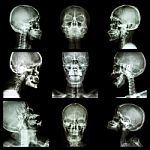 Collection Of Asian Skull (thai People) Stock Photo