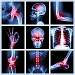 Collection X-ray And Multiple Injury Stock Photo