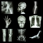 Collection X-ray Part Of Human Stock Photo