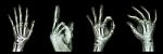 Collection X-ray Symbol Hands Stock Photo