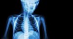Film X-ray Body Of Child And Blank Area At Right Side ( Medical Background ) Stock Photo