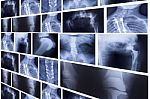 Group Of X-rays On Light Board Stock Photo