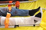 Leg With Splint Stock Photo