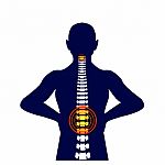 Medical Concept Illustration Of Musculotendinous Strain Back Ache Or Lumbar Pain Stock Photo