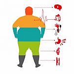 Obesity Related Diseases ,man Health Info Graphic. Fat And Health Man Stock Photo