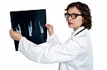 Serious Female Doctor Showing The X-ray Sheet Stock Photo