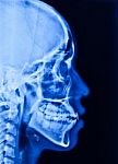 X-ray Stock Photo