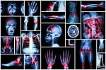 X-ray Multiple Disease Stock Photo