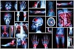 X-ray Multiple Disease Stock Photo